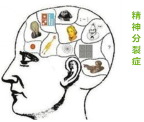 精神分裂症新机制